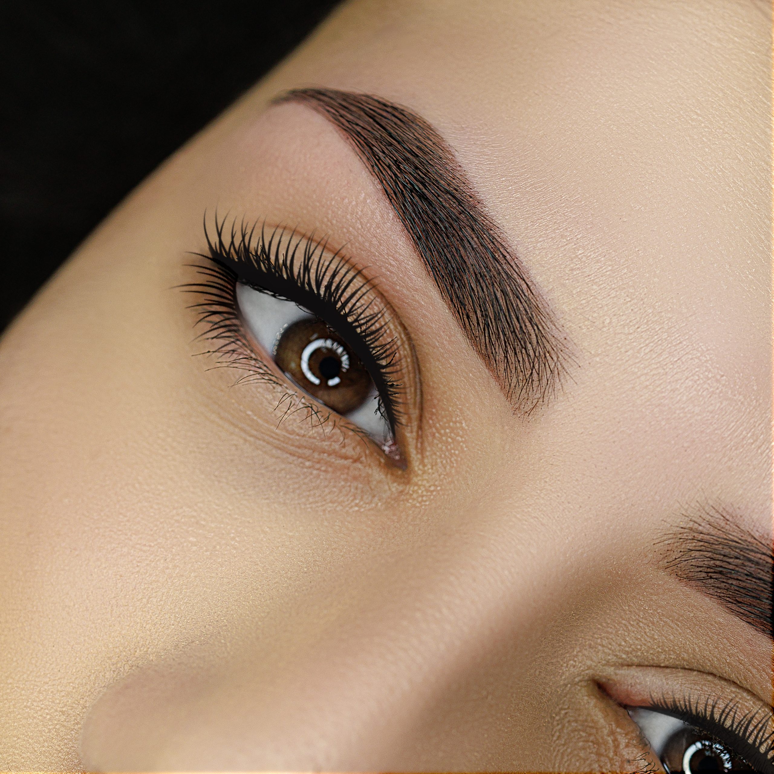 Browlift